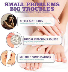 Nail Fungus Spray